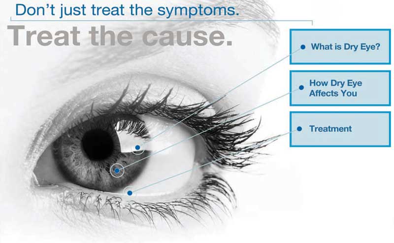 Dry Eye Diagram