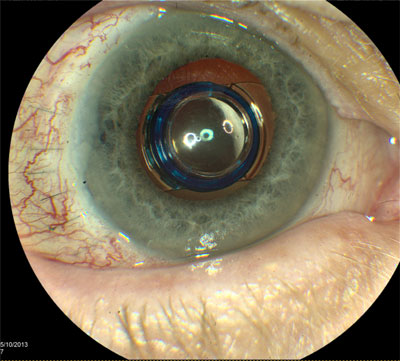 Clseup of an eye