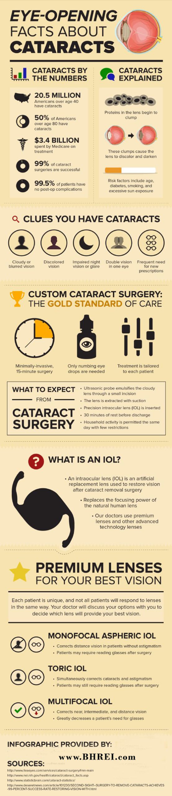 Cataract Info