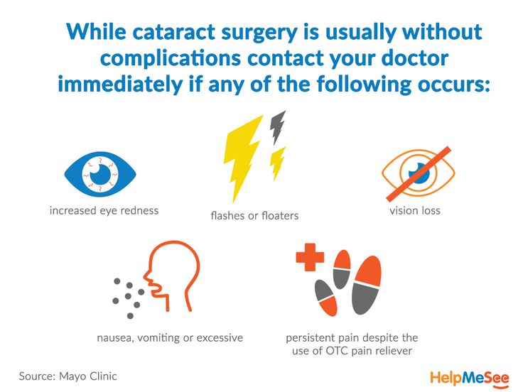 After Cataract Surgery
