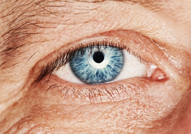 Glare After LASIK Surgery