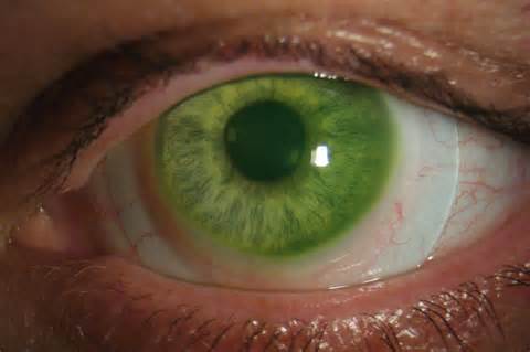 Closeup of a green eye