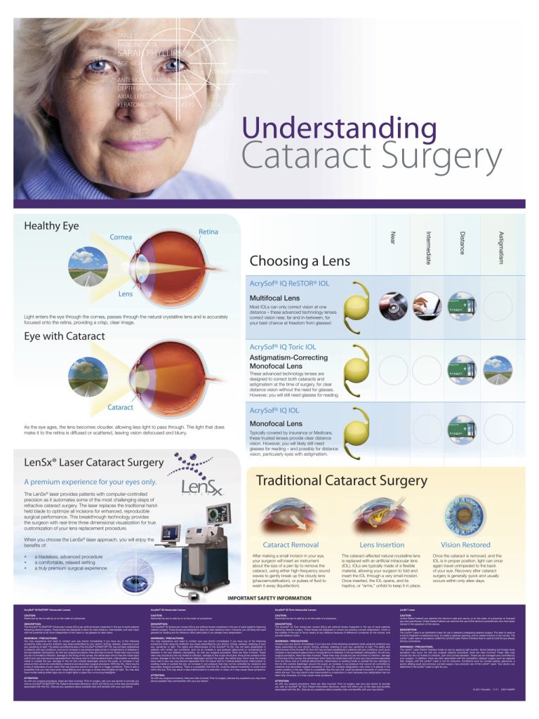 Understanding cataract surgery information sheet